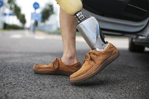 假肢價格多少錢初次安裝假肢應(yīng)該如何做呢?(圖1) 假肢價格多少錢初次安裝假肢應(yīng)該如何做呢?(圖1)