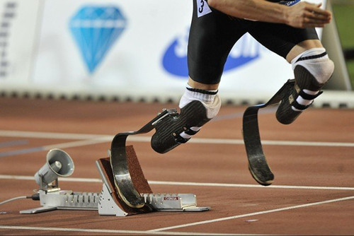 患者安裝臨時假肢和長期性假肢區別在哪(圖1) 患者安裝臨時假肢和長期性假肢區別在哪(圖1)