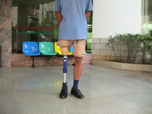 假肢價格的形成需要經過哪三個環節?(圖2) 假肢價格